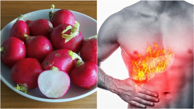 Củ cải đỏ tốt cho gan Củ cải đỏ tốt cho gan